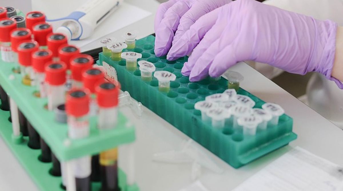 Amostras de sangue e urina organizadas em laboratório para exames de investigação